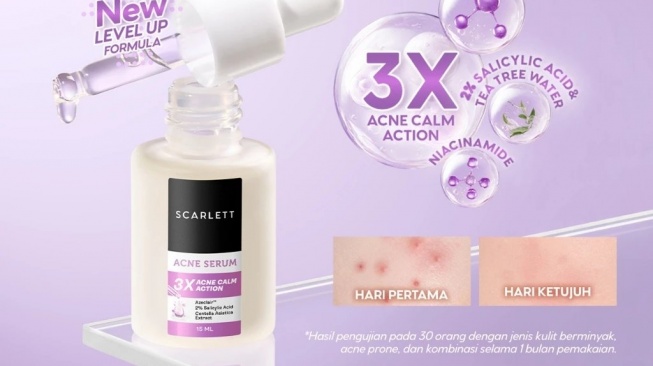 Scarlett Acne Serum (3X Acne Calm Action) (Shopee)