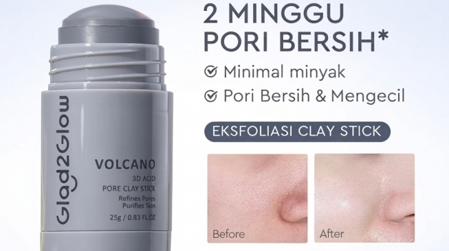 Glad2Glow Volcano 3D Acid Pore Clay Stick (Shopee)