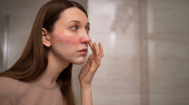 ilustrasi rosacea di wajah [Magnific]