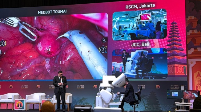Forum Asia Pacific Association for Gynecologic Surgery (APAGE) 26th Annual Meeting di Jimbaran, JCC, Bali. (Dok. Istimewa)