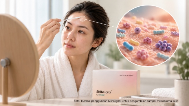 Rajin Pakai Skincare tapi Jerawat Masih Muncul? Kenali Dulu Apa Itu Mikrobioma Kulit