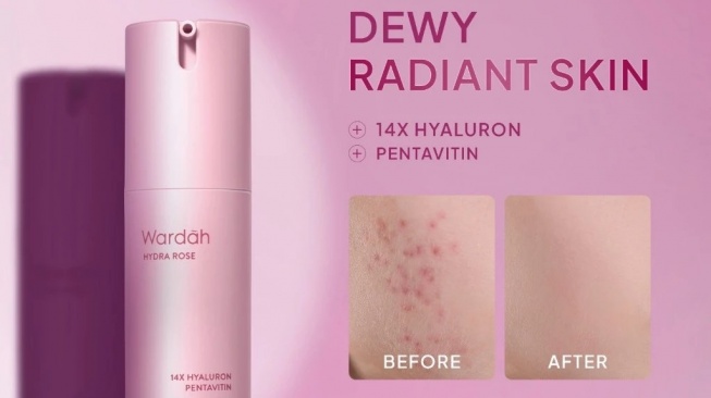 WARDAH Hydra Rose 14X Hyaluronic Pentavitin Deep Barrier Repair Serum (Shopee)