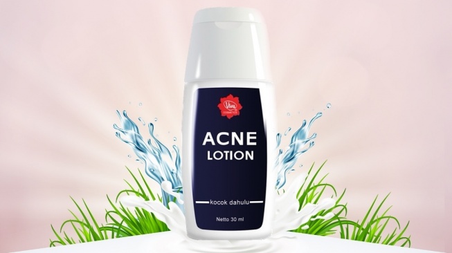 Viva Acne Lotion