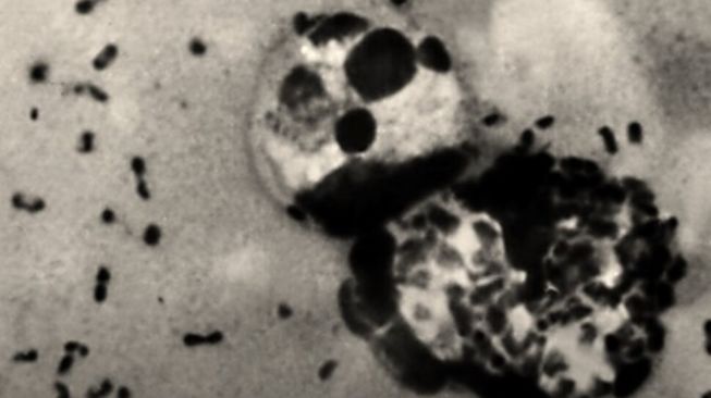 Apa Itu Bakteri Yersinia Pestis? Diduga Bocor di Lab RUsia, Sumber dari Wabah Black Death