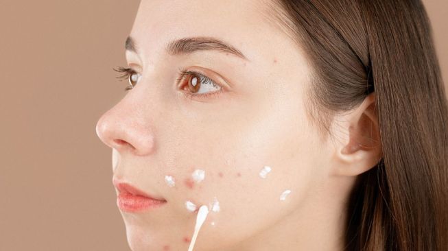 Pakai Obat Totol Jerawat Sebelum atau Sesudah Moisturizer? Ini Urutan yang Tepat