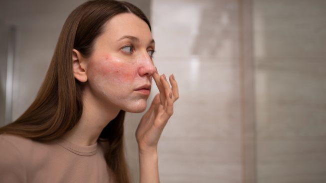 7 Cara Mengatasi Kulit Perih dan Memerah saat Mencoba Krim Retinol agar Iritasi Mereda