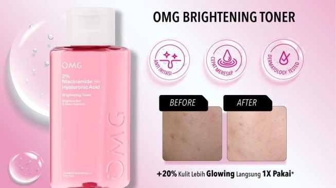OMG Oh My Glow 2% Niacinamide Pro Hyaluronic Acid Brightening Toner (Shopee)