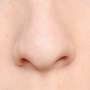 Idap Kanker Rongga Hidung, Pria ini Kehilangan Hampir Setengah Wajahnya!