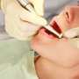 Jangan Takut Berobat Ke Dokter Gigi, Tindakan Perawatan Gigi Ini Gak Bikin Puasa Batal Kok!