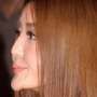 Operasi Plastik Kadaluarsa, Model Cantik Ini Berubah jadi Aneh