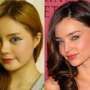 Ingin Mirip Miranda Kerr, Perempuan Ini Operasi Wajahnya