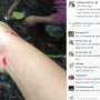 Jenny Cortez Menangis Digigit Ular Sampai Berdarah