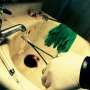 Horor, Cina 'Memanen' Organ Tubuh Tahanan dalam Keadaan Hidup