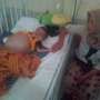 Innalillahi, Bayi Penderita Tumor Perut di Aceh Meninggal Dunia