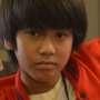 Ini 'Cacat' yang Dialami Iqbaal CJR akibat Kecelakaan Motor