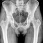 RSUI Dapat Instalasi X-Ray Canggih dengan Kecerdasan Buatan: Bisa Buat Foto Rontgen Banyak Penyakit!