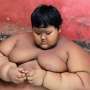Bocah 10 Tahun Ini Miliki Bobot 192 Kg