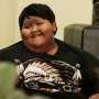 Ini Mengapa Obesitas Bisa Picu Penyakit Jantung