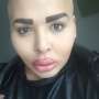 Ingin Mirip Kim Kardashian, Bibir Laki-laki Ini Malah 'Jontor'