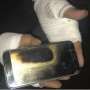 Galaxy S7 Meledak di Tangan Lelaki Ini