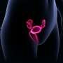 Tentang Keperawanan dan Kehamilan Ektopik