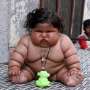 Ini Bayi Tergemuk di Dunia, Baru 8 Bulan Beratnya 20 Kg