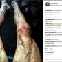 Foto Kaki "Mengerikan" Pebalap Tour de France Ini Bikin Heboh