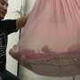 Kisah Bayi Syakira Lahir Tanpa Bola Mata