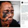 Cinta Tanah Air, Lelaki Ini Tato Wajahnya dengan Peta Indonesia