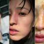 Horor! Kena Pewangi Ruangan, Wajah Gadis Cantik Ini Rusak