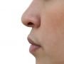 Bahaya bagi Paru-Paru, Dokter Larang Oleskan Vicks di Lubang Hidung