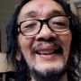 Sebelum Meninggal, Yockie Suryo Prayogo Alami Pendarahan