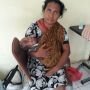 Kisah Desi dari NTT, Bawa Putri Kembarnya ke Jakarta Karena Tumor