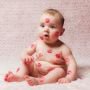 Ini Risikonya Kalau Sering Cium Bibir Bayi