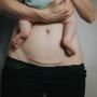 Catat! Ini Perubahan Tubuh Perempuan Usai Melahirkan