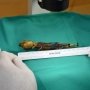 Ilmuwan Temukan Janin Mungil, Bayi Alien?
