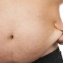 Obesitas Ternyata Bisa Pengaruhi Fungsi Otak
