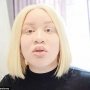 Perempuan Albino Buktikan Tak Harus Sempurna Untuk Jadi Model