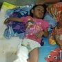Rem Blong, Truk Aspal Tabrak Kaki Nabila Hingga Patah