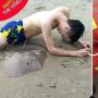 Alat Kelamin Wisatawan Ini Disengat Ikan Pari di Pantai Cina