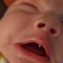 Bayi 11 Minggu Viral usai Tumbuh Gigi Taring Seperti Vampir