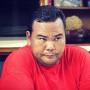 Derita Diabetes dan Asam Urat Parah sampai Menyerang Kaki, Fahmi Bo Ngaku Tak Punya Uang untuk Berobat