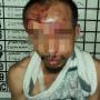 Maling... maling... Sugiono Merintih Babak Belur Gagal Curi Motor