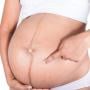 Linea Nigra pada Ibu Hamil Bisa Prediksi Jenis Kelamin Bayi?