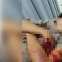 Disantroni Saat Tidur di Bengkel, Dendi Dibacok Perampok Hingga Luka Parah