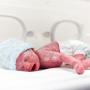 Bukan Karena Sering Tidur Siang, Ini Fakta Vernix Caseosa di Kulit Bayi