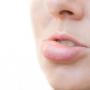 Tiba-tiba Bibir Bengkak saat Bangun Tidur, Ini Penyebab dan Mengatasinya