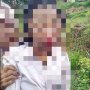 Ditemukan Babak Belur, Siswi SMP Nyaris Diperkosa Saat Berangkat Sekolah