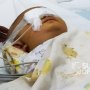 Jamkesda Dicabut, Balita Koma di Sukabumi Utang Rp 22 Juta ke Rumah Sakit