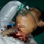 Senjata Makan Tuan, SN Tertancap Pisau di Leher Saat Mau Bunuh Selingkuhan